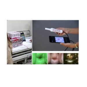 Smart Scope