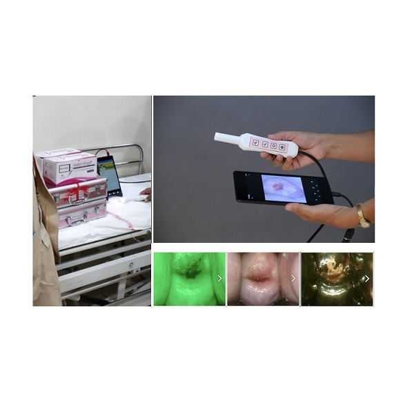 Smart Scope