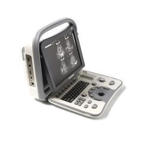 SonoScape A6 Portable Ultrasound Machine -