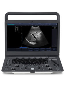 SonoScape E1, Portable B/W Doppler System – OB/GYN(MFG: 2019) - NEW