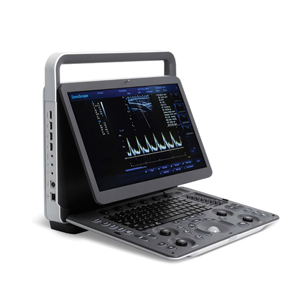 SonoScape E1, Portable B/W Doppler System – MSK/Small Parts/Vascular/Podiatry(MFG: 2019) - NEW