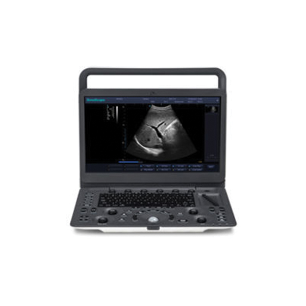 SonoScape E1, Portable B/W Doppler System – MSK/Small Parts/Vascular/Podiatry(MFG: 2019) - NEW - Image 2