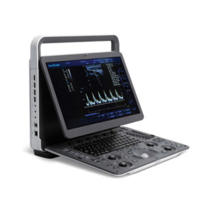 SonoScape E1 Ultrasound Machine -