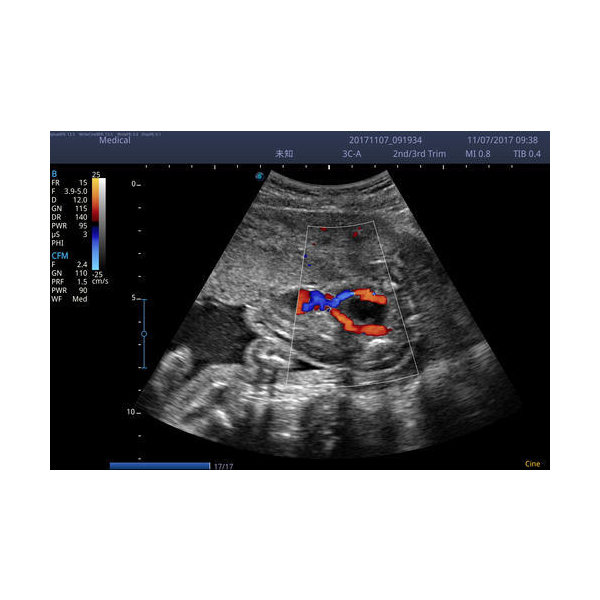 SonoScape E2 Color Doppler - Image 3