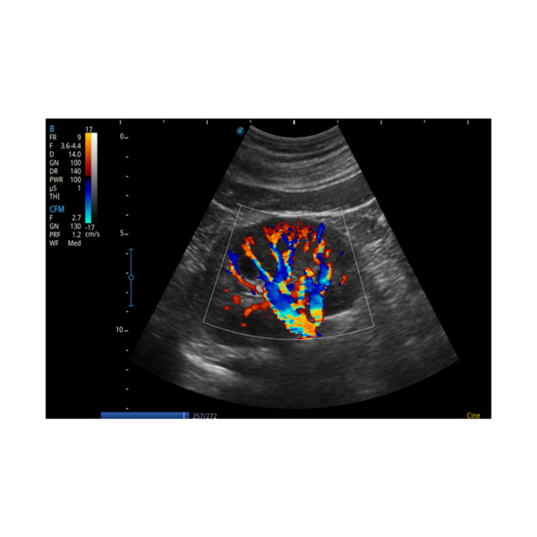 SonoScape E2 Color Doppler - Image 4