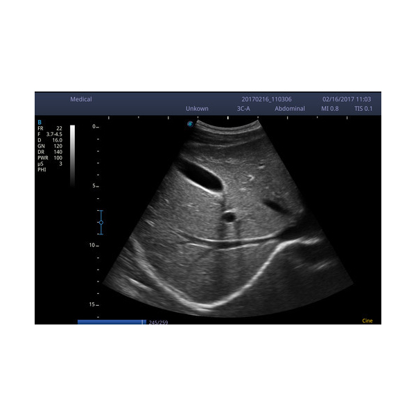 SonoScape E2 Color Doppler - Image 5
