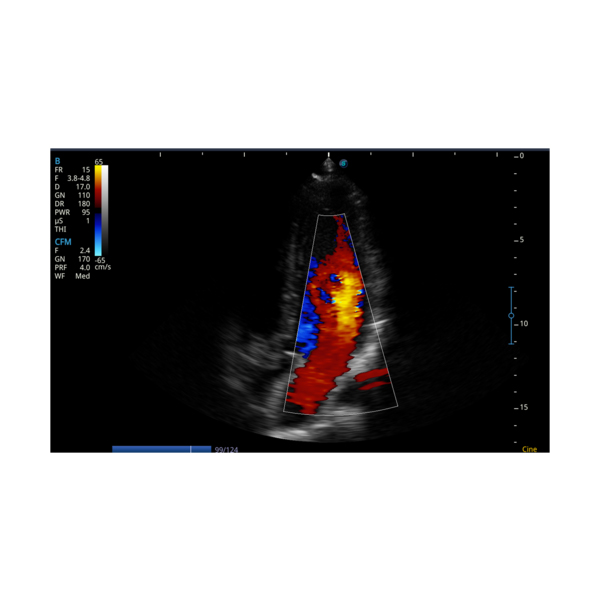 SonoScape E2 Color Doppler - Image 6