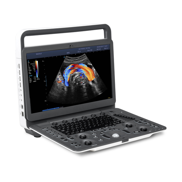 SonoScape E2 Color Doppler