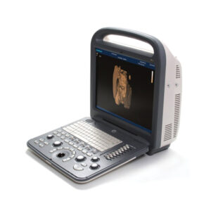 SonoScape S2 Ultrasound Machine -