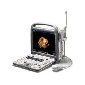 SonoScape S8 Ultrasound Machine -
