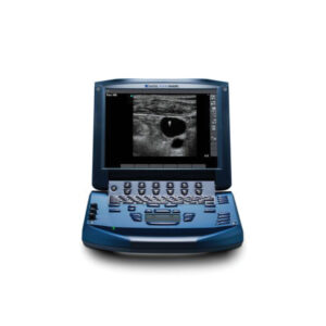 Sonosite MicroMaxx
