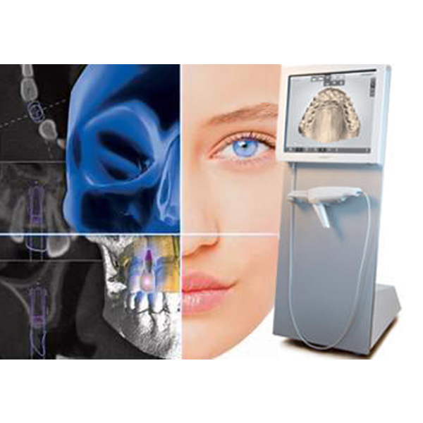 TRIOS 3 in 1 Digital Impression Scanning - Image 4