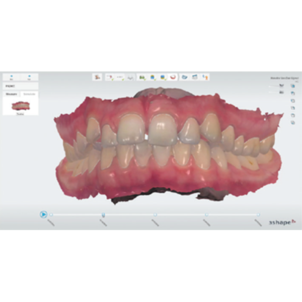TRIOS 3 in 1 Digital Impression Scanning - Image 8