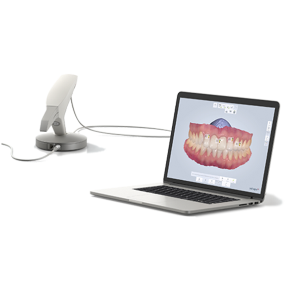 TRIOS 3 in 1 Digital Impression Scanning