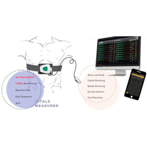 Telemetric Patient Monitoring system