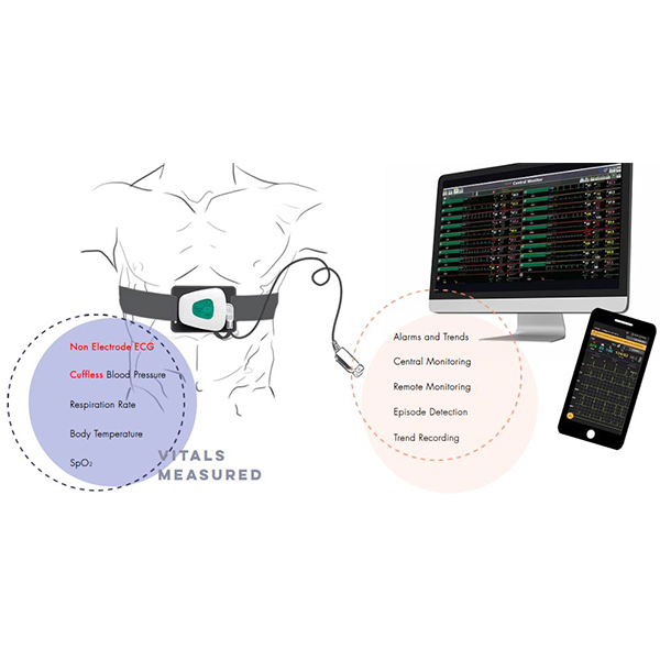 Telemetric Patient Monitoring system