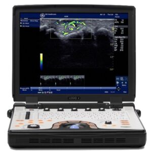 GE NextGen LOGIQ e Ultrasound Machine -