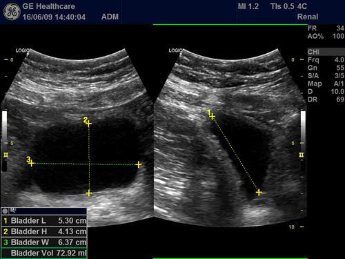 GE Volusion G8 Ultrasound - Image 5