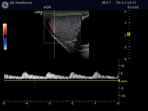 GE Volusion G8 Ultrasound - Image 3