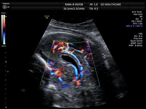 GE Voluson S8 Ultrasound - Image 2