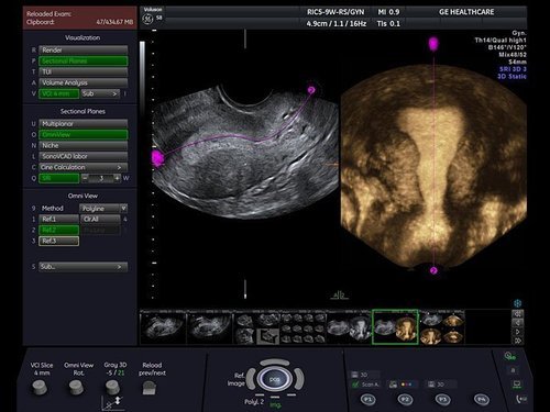 GE Voluson S8 Ultrasound - Image 3