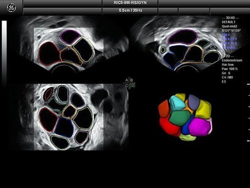 GE Voluson S8 Ultrasound - Image 4