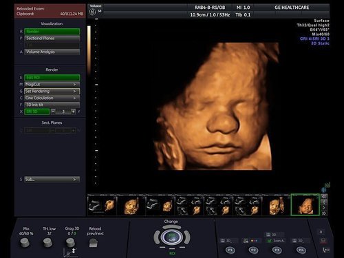 GE Voluson S8 Ultrasound - Image 5