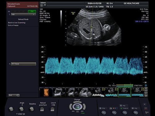 GE Voluson S8 Ultrasound - Image 6