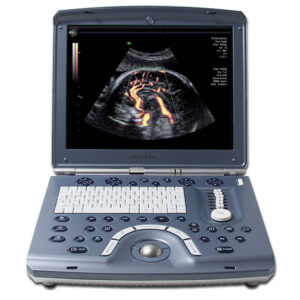 GE Voluson i Ultrasound Machine -