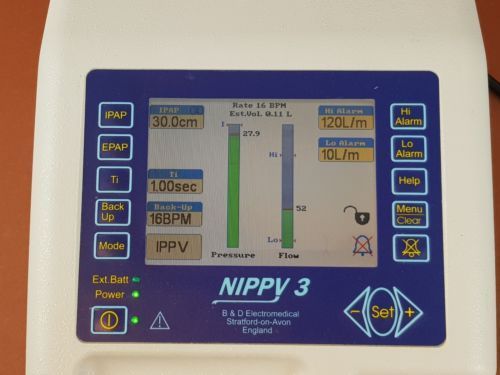 Nippy 3 Portable Respiratory Ventilator - Image 3