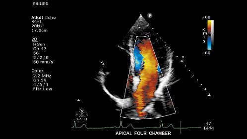 Philips Clear Vue 550 Ultrasound - Image 4