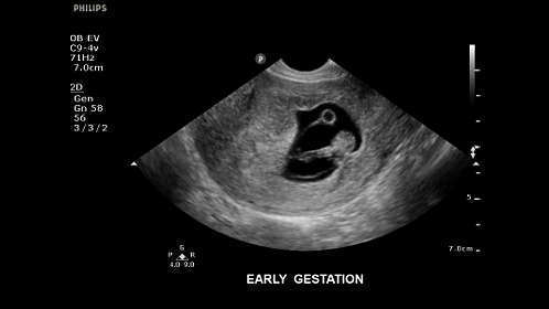 Philips Clear Vue 550 Ultrasound - Image 5