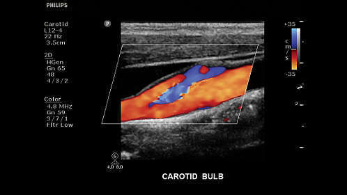 Philips Clear Vue 550 Ultrasound - Image 7