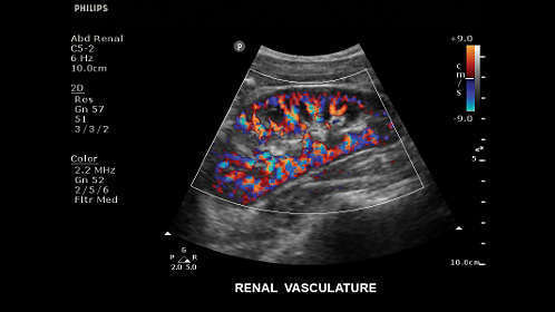 Philips Clear Vue 550 Ultrasound - Image 8