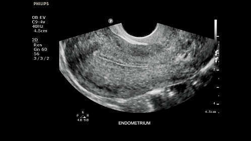 Philips Clear Vue 550 Ultrasound - Image 9