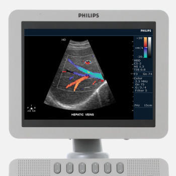 Philips HD7 Ultrasound Machine - Image 7