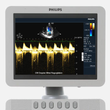 Philips HD7 Ultrasound Machine - Image 8