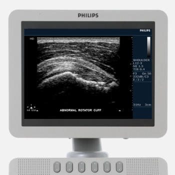 Philips HD7 Ultrasound Machine - Image 9