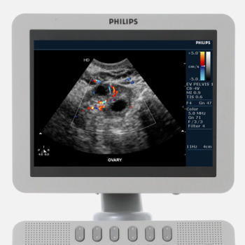 Philips HD7 Ultrasound Machine - Image 11