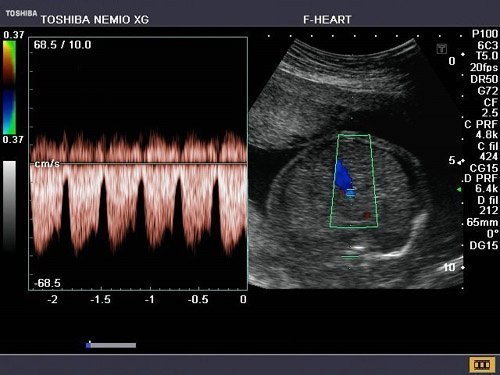 Toshiba Nemio XG Ultrasound Machine - Image 6