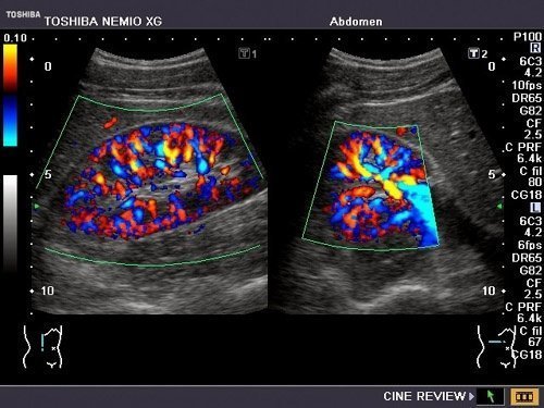 Toshiba Nemio XG Ultrasound Machine - Image 7