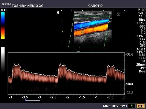 Toshiba Nemio XG Ultrasound Machine - Image 8