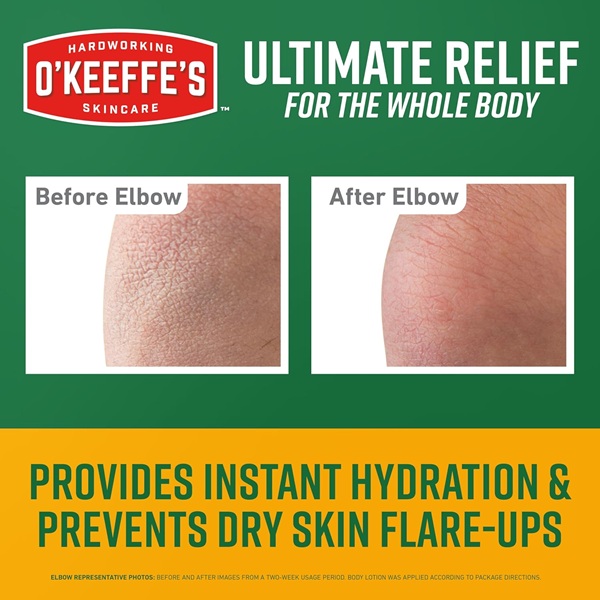 O'Keeffe'S Skin Repair Body Lotion And Dry Skin Moisturizer, Tube, 3 Ounce - Image 2